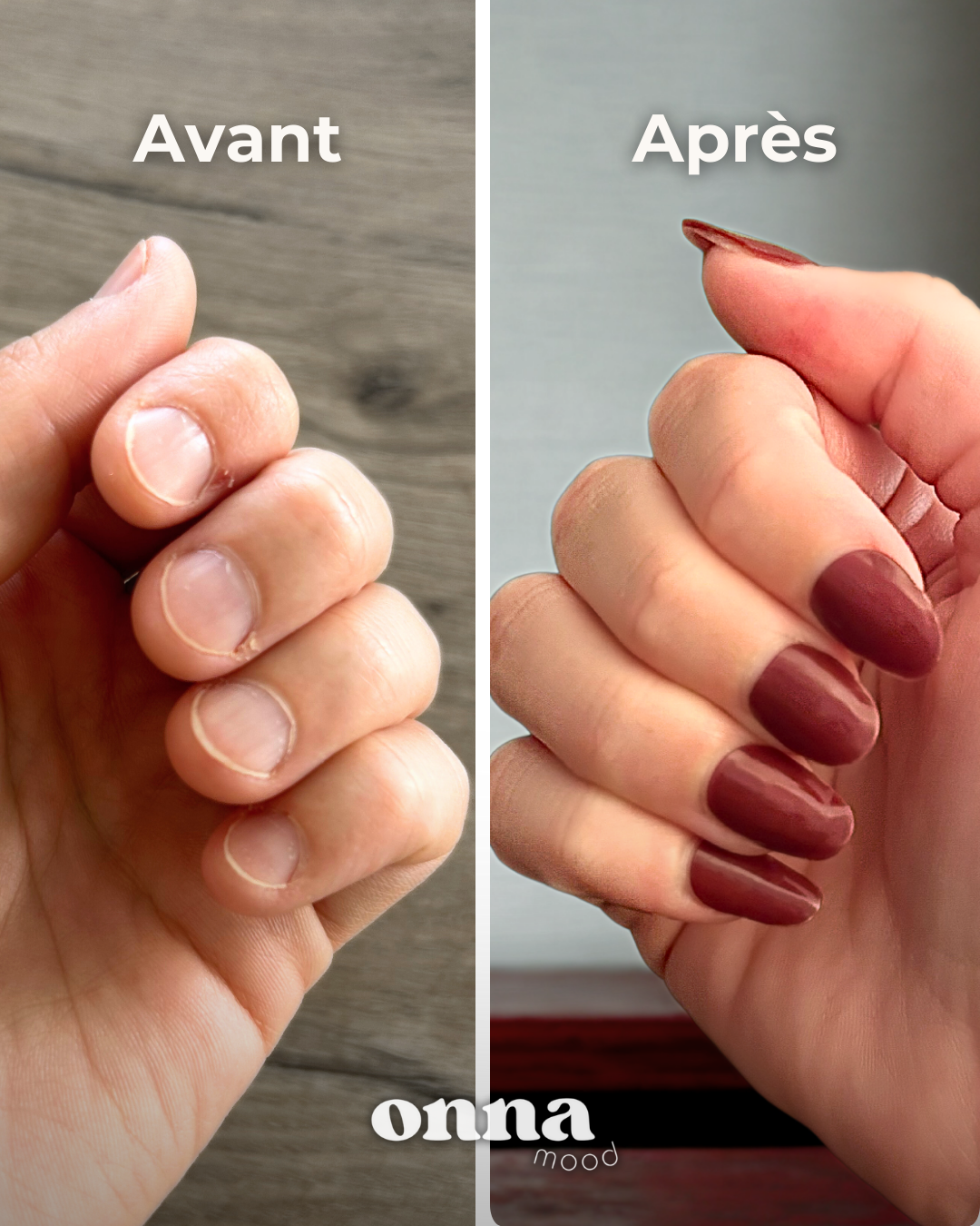 Bande de gel